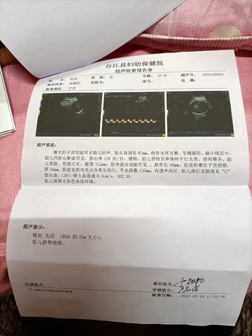 journal_insert_pic_1719631132