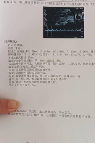 journal_insert_pic_1677954100