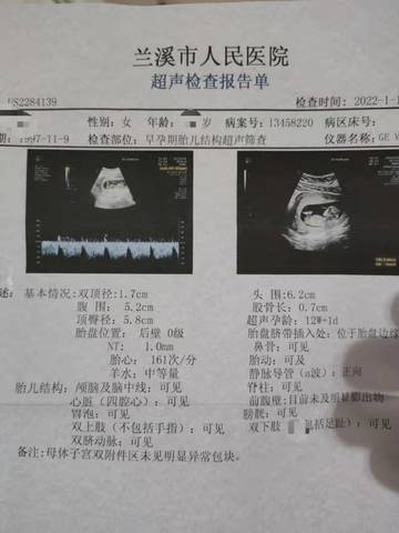 journal_insert_pic_1690089460