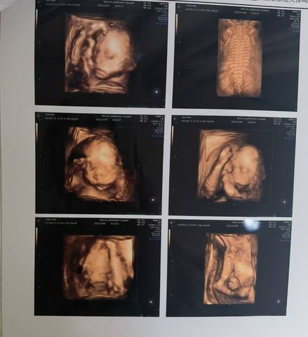 journal_insert_pic_1675897519