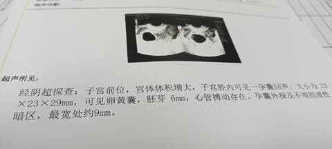 journal_insert_pic_1719617046