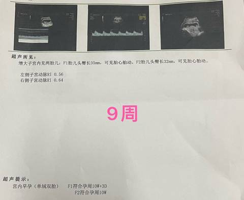 journal_insert_pic_1741145658