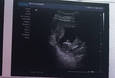 journal_insert_pic_1677697975