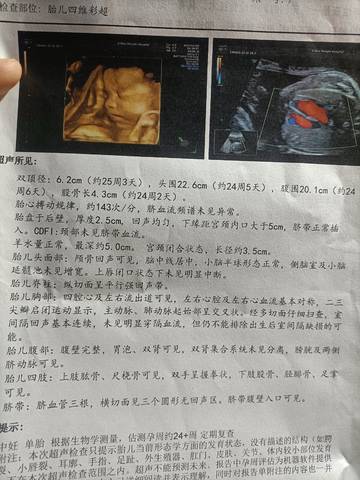 journal_insert_pic_1690243475
