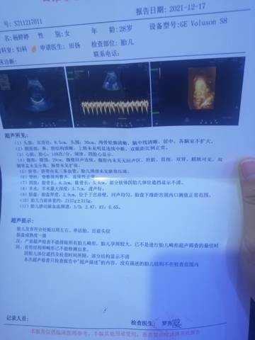 journal_insert_pic_1687347712