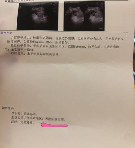journal_insert_pic_1676273101