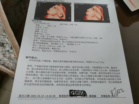 journal_insert_pic_1740865540