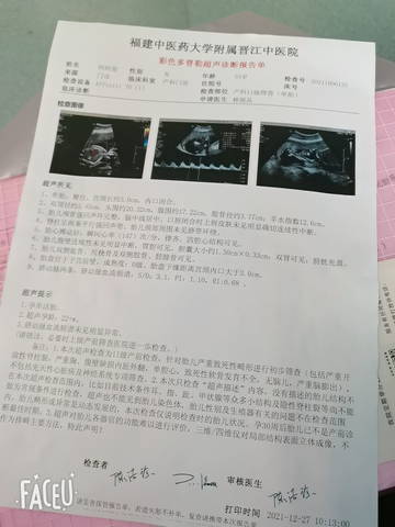 journal_insert_pic_1687237225