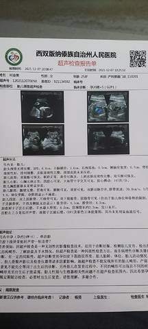 journal_insert_pic_1675495449