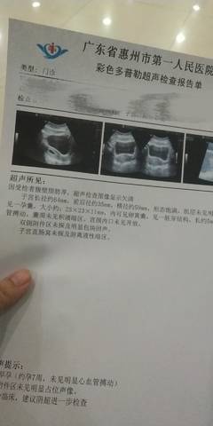 journal_insert_pic_1681543765