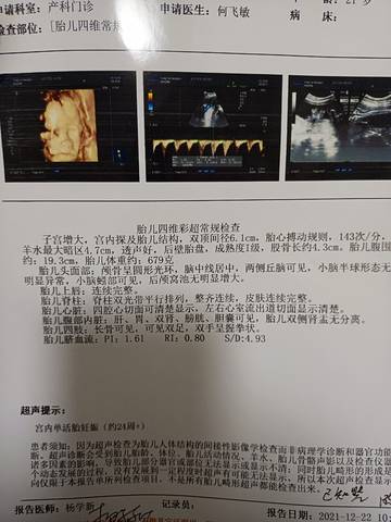journal_insert_pic_1689133359