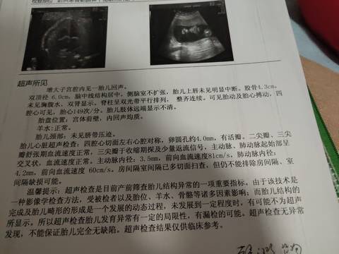 journal_insert_pic_1682615736
