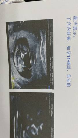 journal_insert_pic_1682766047