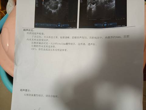 journal_insert_pic_1674103933