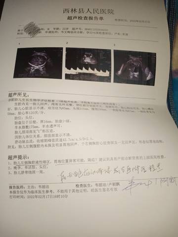 journal_insert_pic_1719720087