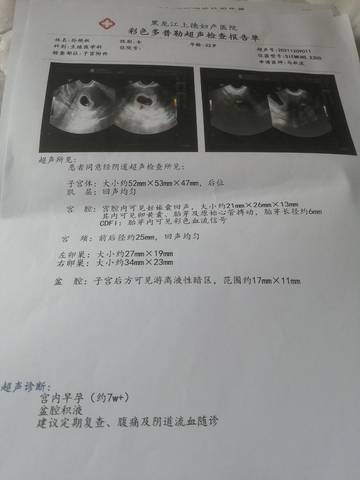 journal_insert_pic_1676703128