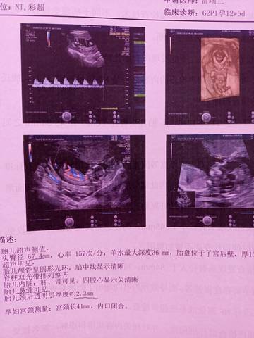 journal_insert_pic_1677456723