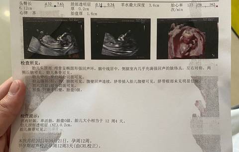 journal_insert_pic_1680132985