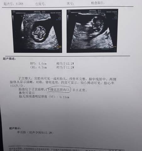 journal_insert_pic_1685885834