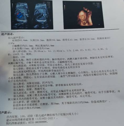 journal_insert_pic_1678500937