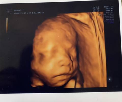 journal_insert_pic_1689744279