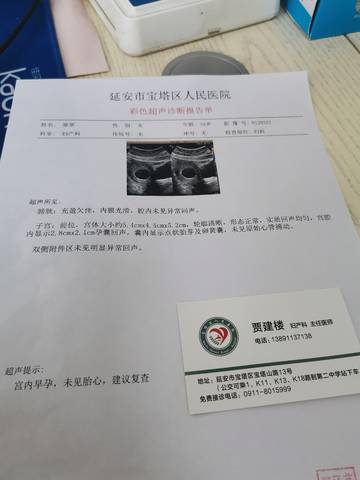 journal_insert_pic_1675381343
