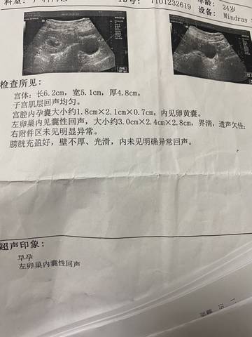 journal_insert_pic_1683825920
