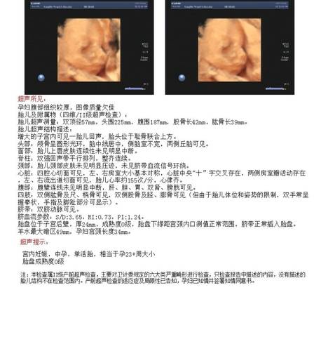 journal_insert_pic_1678640261