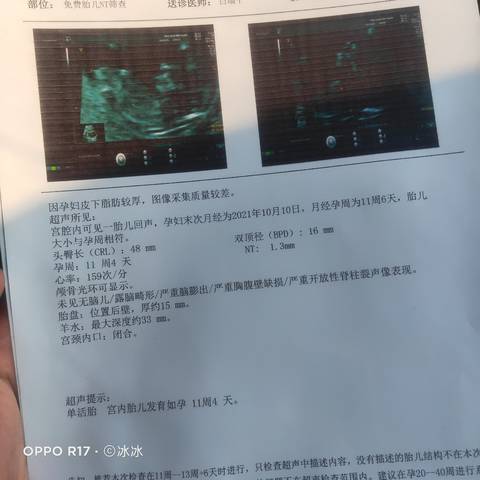 journal_insert_pic_1690235595