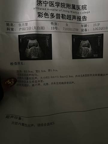 journal_insert_pic_1685259446