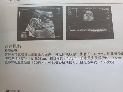journal_insert_pic_1688945903