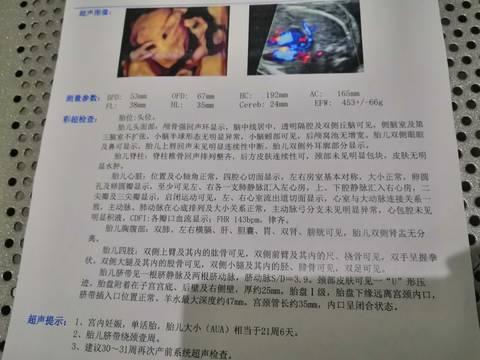 journal_insert_pic_1676652745