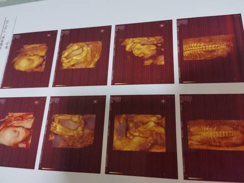 journal_insert_pic_1684441600