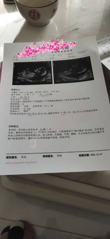 journal_insert_pic_1684311760