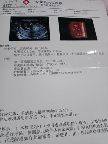 journal_insert_pic_1687312202