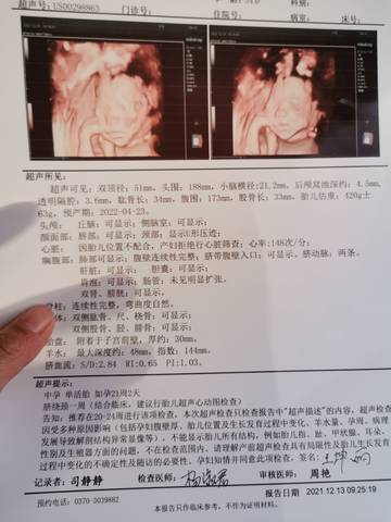 journal_insert_pic_1679172252