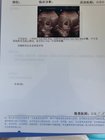 journal_insert_pic_1719488977