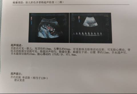 journal_insert_pic_1686024126
