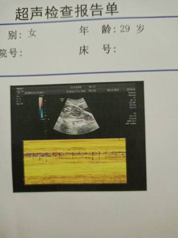 journal_insert_pic_1676004659