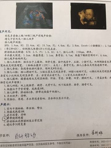 journal_insert_pic_1683746851