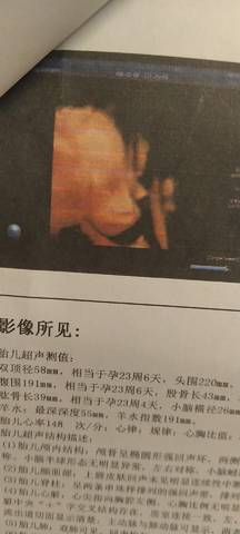 journal_insert_pic_1681053698