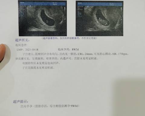 journal_insert_pic_1681179931