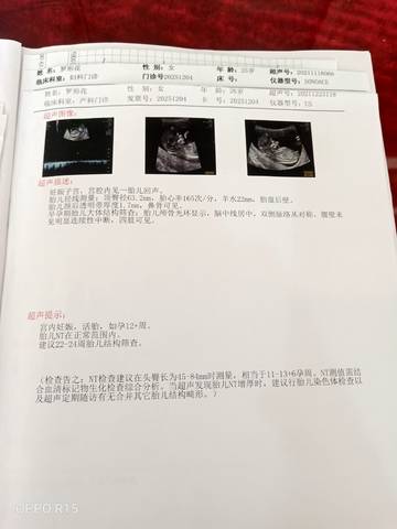 journal_insert_pic_1686930834