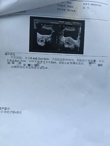 journal_insert_pic_1688719080