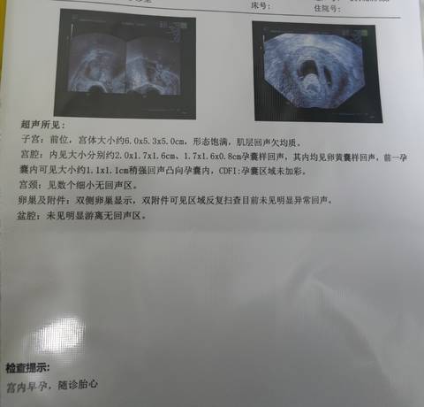journal_insert_pic_1688679500