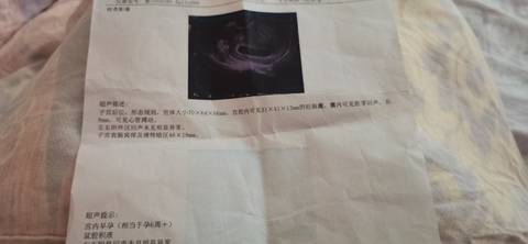 journal_insert_pic_1741074359