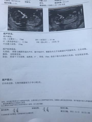 journal_insert_pic_1683716796