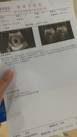 journal_insert_pic_1684222530