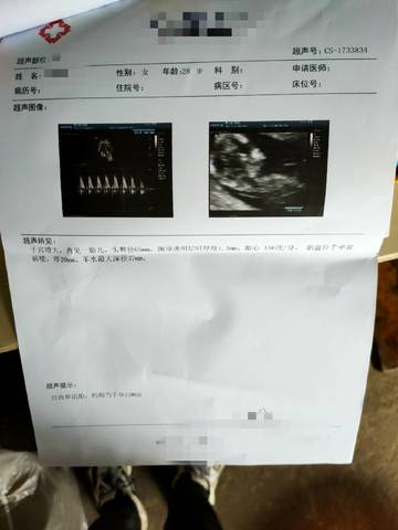 journal_insert_pic_1680972929
