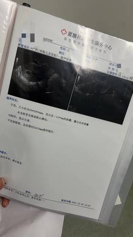 journal_insert_pic_1689580383